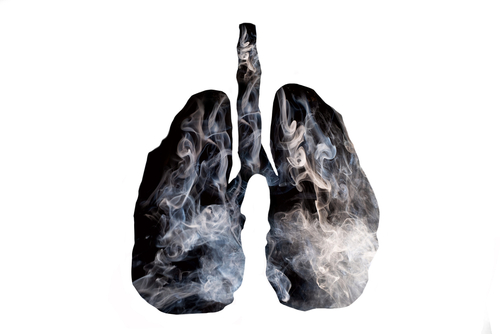 lung damage from vaping