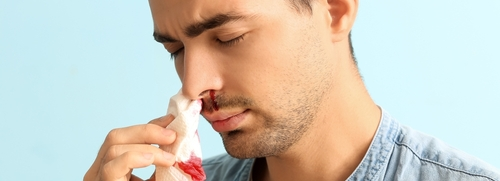 man having nosebleed